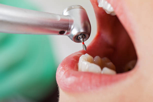 Best Weekend Emergency Dental Services in Thomas, OK